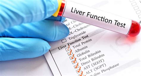 liver soft tissue test|types of liver function tests.